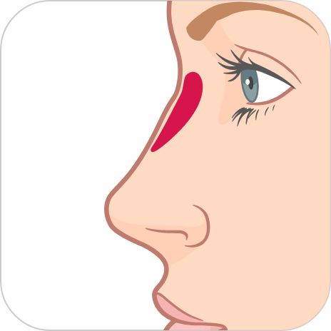 シリコンプロテーゼ