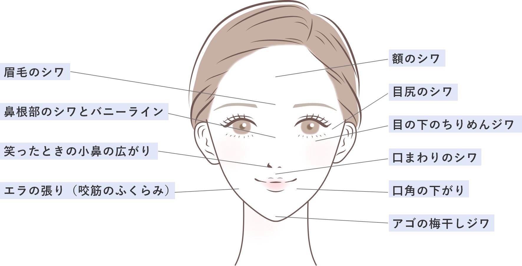 顔のボトックス